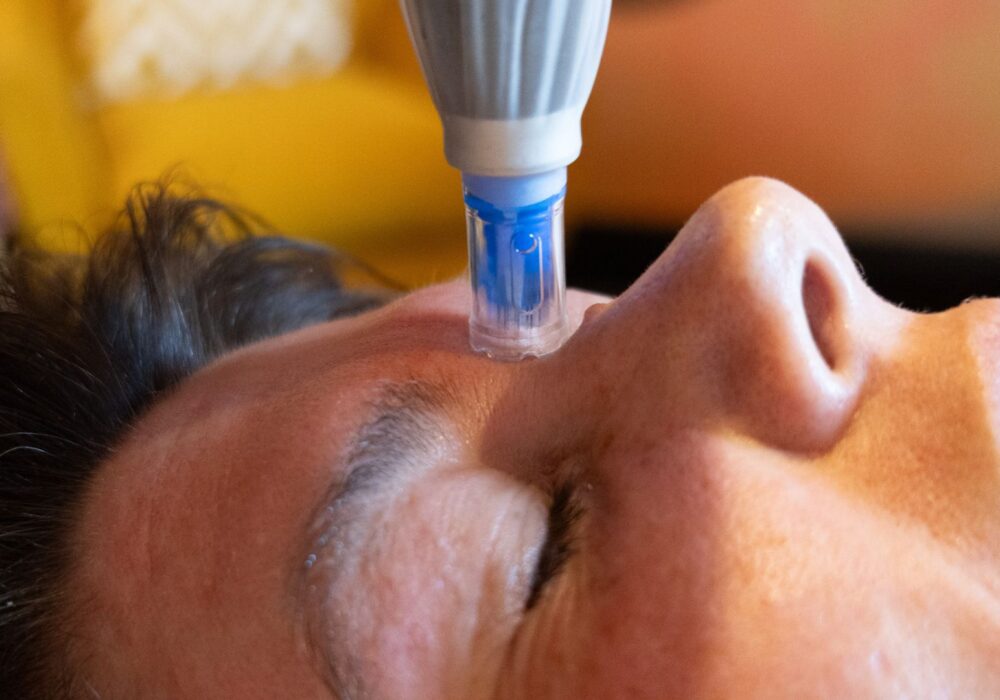 Dermapen Collagen Induction Therapy at Mabin House Nelson