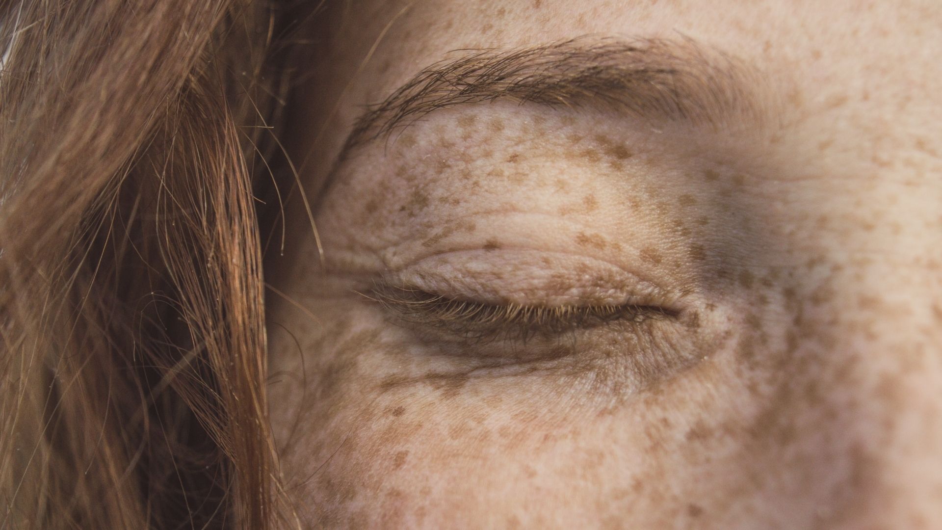 Professional pigmentation assessment consultation